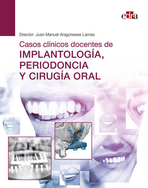 CASOS CLÍNICOS DOCENTES DE IMPLANTOLOGÍA, PERIODONCIA Y CIRUGÍA ORAL *